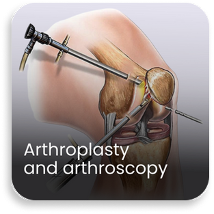 Medical illustration showing arthroplasty and arthroscopy procedures performed in the orthopedic department of a bone and joint hospital