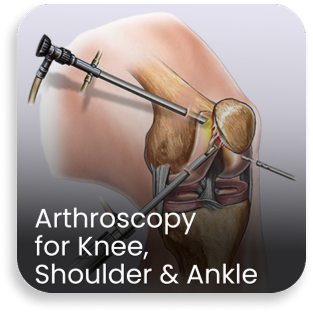 Medical illustration showing arthroscopic surgery for knee, shoulder, and ankle performed in the orthopedic department of a bone and joint hospital