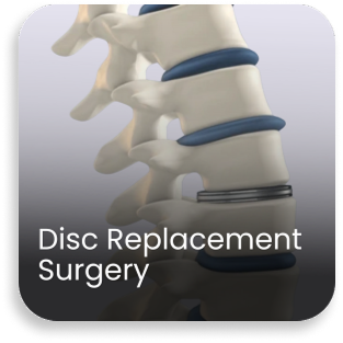 Medical illustration showing spinal disc replacement procedure performed in the orthopedic department of a bone and joint hospital
