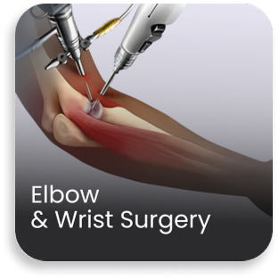 Medical illustration showing elbow and wrist surgery using advanced orthopedic techniques at a bone and joint care hospital
