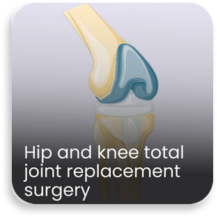 Illustration of hip and knee total joint replacement showing artificial joints used in advanced orthopedic surgery at a bone and joint hospital