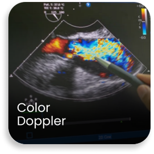 Color Doppler ultrasound scan showing blood flow during an advanced radiology examination in a hospital