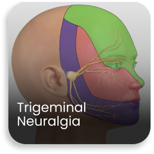 Medical illustration showing trigeminal nerve pain distribution on the face treated at a best neurology hospital in India