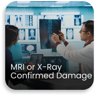 Orthopaedic doctor reviewing MRI and X-ray scans with patient to confirm joint damage, helping diagnose knee or shoulder injuries for accurate arthroscopy treatment planning.