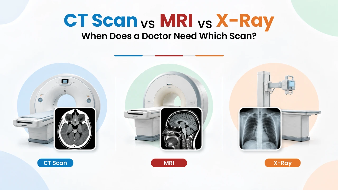 CT scan vs MRI vs X-ray explained simply: how each works, radiation, scan time, cost and which scan your doctor picks for injury, stroke or back pain.jthufy